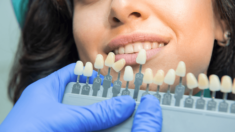 Clareando - dentista mostrando opções