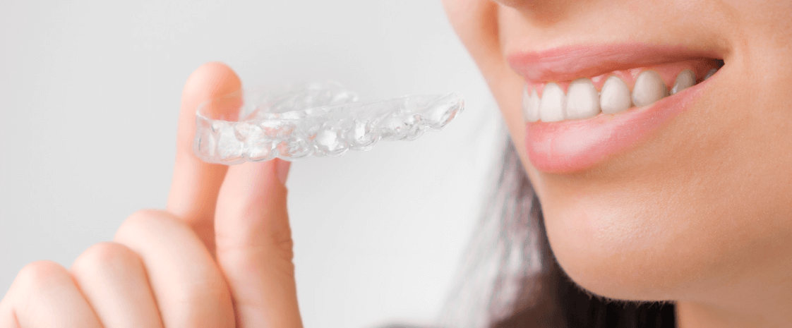 How Much Do Invisible Braces Cost in Australia?